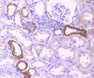 Immunohistochemistry-Paraffin: Pyruvate Dehydrogenase E1 beta subunit Antibody (JM66-33) [NBP2-75639] - Analysis of paraffin-embedded human kidney tissue using anti-Pyruvate Dehydrogenase E1 beta subunit antibody. Counter stained with hematoxylin.