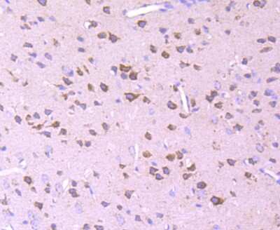 Immunohistochemistry-Paraffin: Pyruvate Dehydrogenase E1 beta subunit Antibody (JM66-33) [NBP2-75639] - Analysis of paraffin-embedded mouse brain tissue using anti-Pyruvate Dehydrogenase E1 beta subunit antibody. Counter stained with hematoxylin.