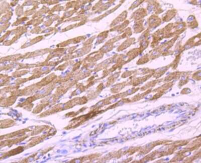 Immunohistochemistry-Paraffin: Pyruvate Dehydrogenase E1 beta subunit Antibody (JM66-33) [NBP2-75639] - Analysis of paraffin-embedded rat heart tissue using anti-Pyruvate Dehydrogenase E1 beta subunit antibody. Counter stained with hematoxylin.