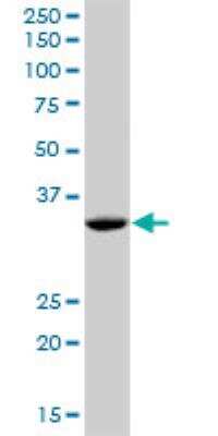 Western Blot: Pyruvate Dehydrogenase E1 beta subunit Antibody [H00005162-B01P] - PDHB MaxPab polyclonal antibody. Western Blot analysis of PDHB expression in human placenta.