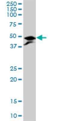 Western Blot: Pyruvate Dehydrogenase E1 beta subunit Antibody [H00005162-B01P] - PDHB MaxPab polyclonal antibody. Western Blot analysis of PDHB expression in rat brain.