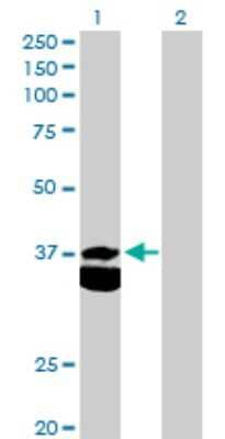 Western Blot: Pyruvate Dehydrogenase E1 beta subunit Antibody [H00005162-D01P] - Analysis of PDHB expression in transfected 293T cell line by PDHB polyclonal antibody.Lane 1: PDHB transfected lysate(39.20 KDa).Lane 2: Non-transfected lysate.