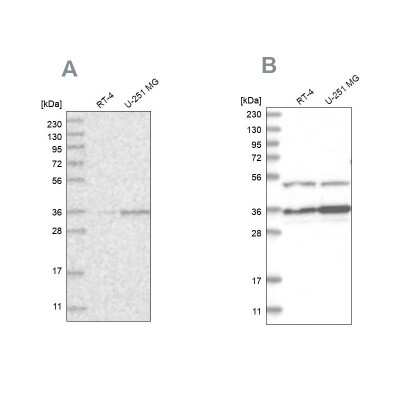 Western Blot: Pyruvate Dehydrogenase E1 beta subunit Antibody [NBP1-87421] - Analysis using Anti-PDHB antibody NBP1-87421 (A) shows similar pattern to independent antibody NBP2-38327 (B).