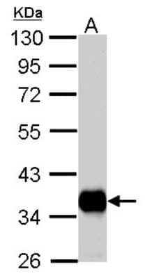 Western Blot: Pyruvate Dehydrogenase E1 beta subunit Antibody [NBP2-20024] - A. 50 ug rat heart lysate/extract 10 % SDS-PAGE Pyruvate Dehydrogenase E1 beta subunit antibody dilution: 1:5000.