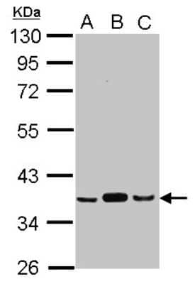 Western Blot: Pyruvate Dehydrogenase E1 beta subunit Antibody [NBP2-20024] - Sample (30 ug of whole cell lysate) A: A549 B: H1299 C: HCT116 10% SDS PAGE gel, diluted at 1:1000.