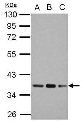 Western Blot: Pyruvate Dehydrogenase E1 beta subunit Antibody [NBP2-20025] - Sample (30 ug of whole cell lysate) A: A549 B: H1299 C: HCT116 10% SDS PAGE gel, diluted at 1:1000.