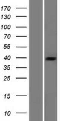 Western Blot: Pyruvate Dehydrogenase E1 beta subunit Overexpression Lysate (Adult Normal) [NBP2-11466] Left-Empty vector transfected control cell lysate (HEK293 cell lysate); Right -Over-expression Lysate for Pyruvate Dehydrogenase E1 beta subunit.