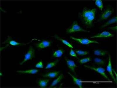 Immunocytochemistry/Immunofluorescence: Pyruvate Dehydrogenase E2 Antibody [H00001737-D01P] - Analysis of antibody to DLAT on HeLa cell. Antibody concentration 30 ug/ml.