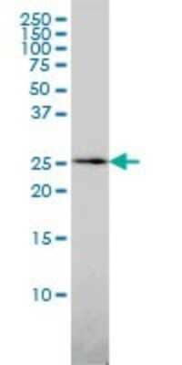 Western Blot: QDPR Antibody (M1) [H00005860-M02] - QDPR monoclonal antibody (M02), clone M1 Analysis of QDPR expression in HL-60.