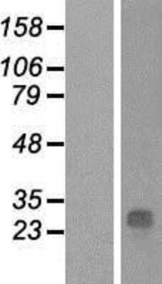 Western Blot: QDPR Overexpression Lysate (Adult Normal) [NBP2-09038] Left-Empty vector transfected control cell lysate (HEK293 cell lysate); Right -Over-expression Lysate for QDPR.