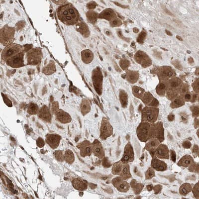 Immunohistochemistry-Paraffin QN1 Antibody - BSA Free
