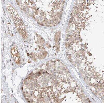 Immunohistochemistry-Paraffin QN1 Antibody - BSA Free