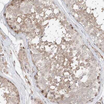Immunohistochemistry-Paraffin QN1 Antibody - BSA Free