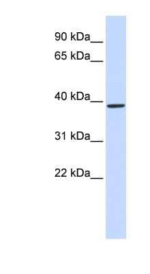 Western Blot: QPCT Antibody [NBP1-79295] - Human Muscle lysate, concentration 0.2-1 ug/ml.