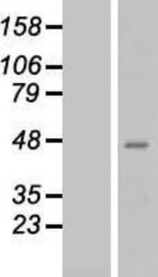 Western Blot: QPCT Overexpression Lysate (Adult Normal) [NBL1-15029] Left-Empty vector transfected control cell lysate (HEK293 cell lysate); Right -Over-expression Lysate for QPCT.