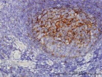 Immunohistochemistry-Paraffin: QPRT Antibody (5D11) [H00023475-M01] - Analysis of monoclonal antibody to QPRT on formalin-fixed paraffin-embedded human tonsil. Antibody concentration 3 ug/ml.