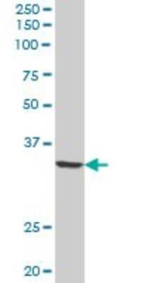 Western Blot: QPRT Antibody [H00023475-B02P] - Analysis of QPRT expression in human liver.