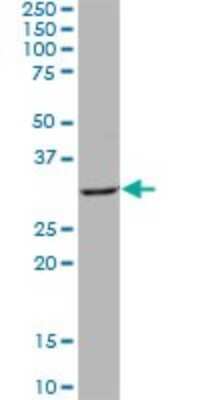 Western Blot: QPRT Antibody [H00023475-B02P] - Analysis of QPRT expression in human placenta.
