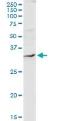 Western Blot: QPRT Antibody [H00023475-D01P] - Analysis of QPRT expression in human kidney.