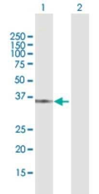 Western Blot: QPRT Antibody [H00023475-D01P] - Analysis of QPRT expression in transfected 293T cell line by QPRT polyclonal antibody.Lane 1: QPRT transfected lysate(32.67 KDa).Lane 2: Non-transfected lysate.