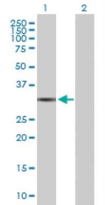 Western Blot: QPRT Antibody [H00023475-D05P] - analysis of QPRT expression in transfected 293T cell line by QPRT MaxPab rabbit polyclonal antibody. Lane 1: QPRT transfected lysate (30.80 KDa). Lane 2: Non-transfected lysate.