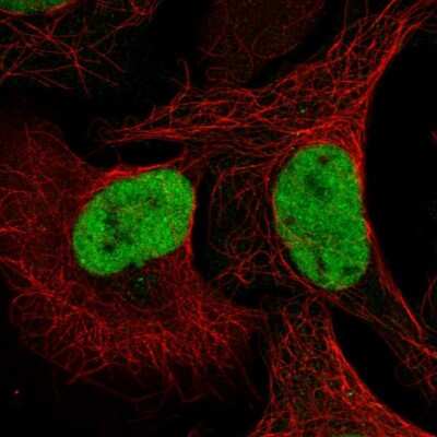 Immunocytochemistry/ Immunofluorescence QRICH1 Antibody - BSA Free