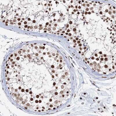 Immunohistochemistry-Paraffin: QRICH1 Antibody [NBP1-82196] - Staining of human testis shows moderate to strong nuclear positivity in cells in seminiferous ducts.