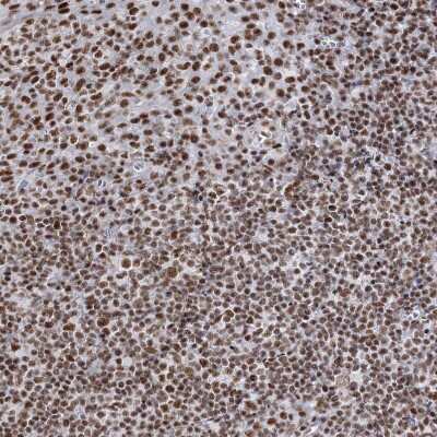 Immunohistochemistry-Paraffin: QRICH1 Antibody [NBP1-82196] - Staining of human tonsil shows strong nuclear positivity in non-germinal center cells.