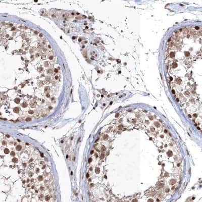 Immunohistochemistry-Paraffin: QRICH1 Antibody [NBP2-32693] - Staining of human testis shows nuclear positivity in cells in seminiferous ducts and Leydig cells.
