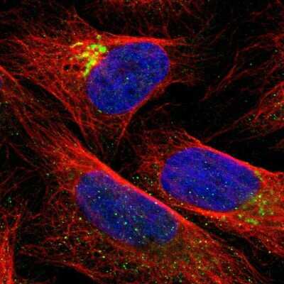 Immunocytochemistry/Immunofluorescence: QSOX2 Antibody [NBP1-84094] - Staining of human cell line U-2 OS shows positivity in golgi apparatus and vesicles. Antibody staining is shown in green.