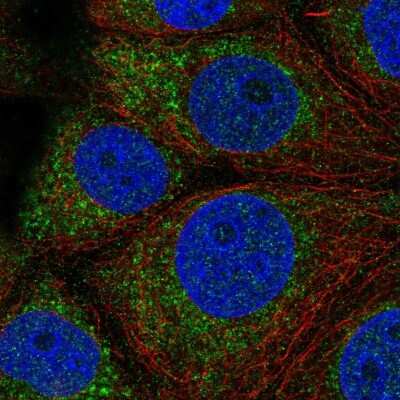 Immunocytochemistry/Immunofluorescence: QTRT1 Antibody [NBP2-59021] - Staining of human cell line MCF7 shows localization to mitochondria.