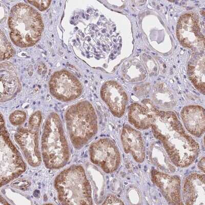 Immunohistochemistry: QTRT1 Antibody [NBP2-47317] - Staining of human kidney shows moderate cytoplasmic positivity in cells in tubules.