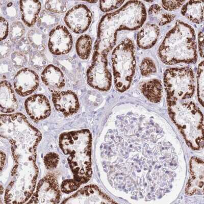 Immunohistochemistry-Paraffin: QTRT1 Antibody [NBP2-48911] - Staining of human kidney shows strong cytoplasmic positivity in cells in tubules.