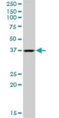 Western Blot: QTRT1 Antibody [H00081890-B01P] - Analysis of QTRT1 expression in Jurkat.
