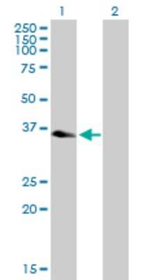 Western Blot: QTRT1 Antibody [H00081890-B01P] - Analysis of QTRT1 expression in transfected 293T cell line by QTRT1 polyclonal antibody.  Lane 1: QTRT1 transfected lysate(39.38 KDa). Lane 2: Non-transfected lysate.