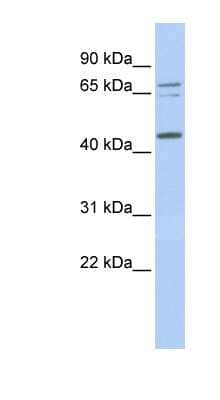 Western Blot: QTRT1 Antibody [NBP1-53056] - MCF-7 whole cell lysates, concentration 0.2-1 ug/ml.