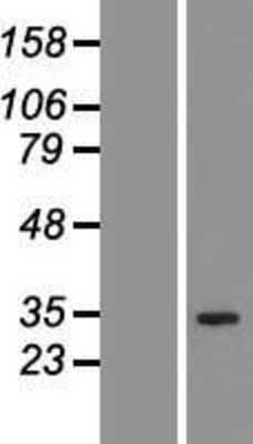 Western Blot: QTRT1 Overexpression Lysate (Adult Normal) [NBP2-06145] Left-Empty vector transfected control cell lysate (HEK293 cell lysate); Right -Over-expression Lysate for QTRT1.