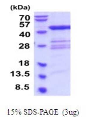 SDS-Page: QTRT1 Recombinant Protein [NBP2-52102] - 15% SDS Page (3 ug)