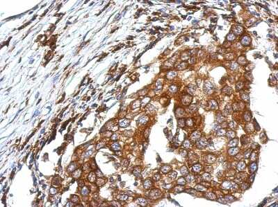 Immunohistochemistry-Paraffin QTRTD1 Antibody