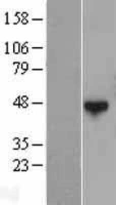 Western Blot: QTRTD1 Overexpression Lysate (Adult Normal) [NBL1-15035] Left-Empty vector transfected control cell lysate (HEK293 cell lysate); Right -Over-expression Lysate for QTRTD1.