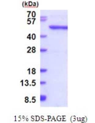 SDS-PAGE Recombinant Human QTRTD1 His Protein