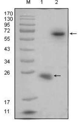 Western Blot: R-Spondin 1 Antibody (7A6) [NBP1-28867] - analysis using anti-R-spondin1 monoclonal antibody against recombinant R-spondin1 protein(1) and R-spondin1(aa21-263)-hIgGFc transfected HEK293 cell lysate(2).