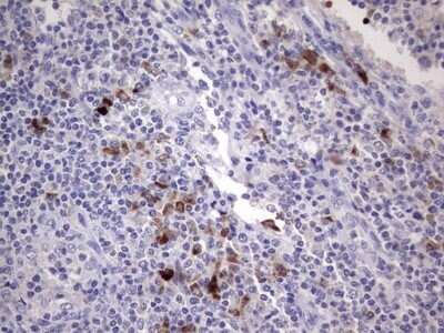 Immunohistochemistry: R-Spondin 1 Antibody (OTI11A9) - Azide and BSA Free [NBP2-73948] - Analysis of Human lymph node tissue. (Heat-induced epitope retrieval by 1 mM EDTA in 10mM Tris, pH8.5, 120C for 3min)