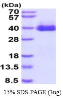 SDS-Page: Recombinant Mouse R-Spondin 1 Protein [NBP2-53068] - 15% SDS-PAGE (3ug)