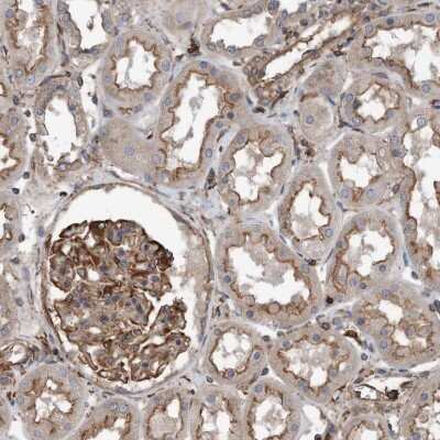 Immunohistochemistry-Paraffin: R-Spondin 3 Antibody [NBP1-82234] - Immunohistochemical staining of human kidney shows moderate to strong membranous positivity in cells in tubules and glomeruli.