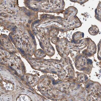 Immunohistochemistry-Paraffin: R-Spondin 3 Antibody [NBP1-82234] - Immunohistochemical staining of human placenta shows moderate membranous positivity in trophoblastic cells.