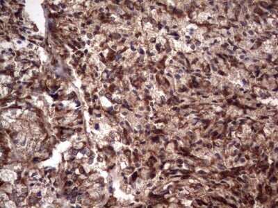 Immunohistochemistry: R-Spondin 3 Antibody (OTI3D5) - Azide and BSA Free [NBP2-73949] - Analysis of Human endometrium tissue. (Heat-induced epitope retrieval by 1 mM EDTA in 10mM Tris, pH8.5, 120C for 3min)