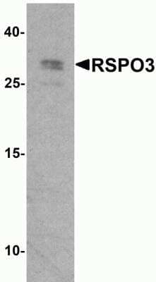 Western Blot: R-Spondin 3 Antibody [NBP2-81849] -  Analysis of RSPO3 in 293 cell lysate with RSPO3 antibody at 1 ug/ml.