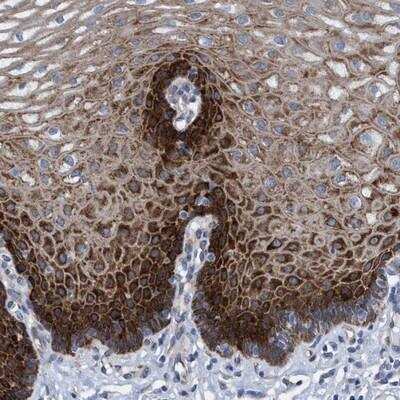 Immunohistochemistry-Paraffin: R3HCC1 Antibody [NBP1-90527] - Staining of human esophagus shows strong cytoplasmic positivity in squamous epithelial cells.