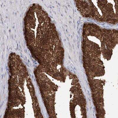 Immunohistochemistry-Paraffin: R3HDM2 Antibody [NBP1-81448] - Staining of human prostate shows strong cytoplasmic and nuclear positivity in glandular cells.